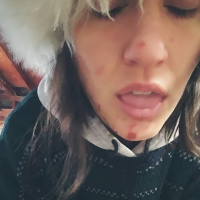 sharkbiteslucy